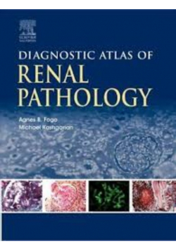 Diagnostic Atlas of Renal Pathology