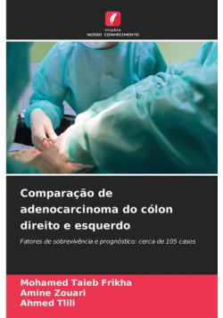 Comparação de adenocarcinoma do cólon direito e esquerdo