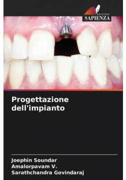 Progettazione dell'impianto