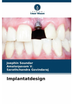 Implantatdesign