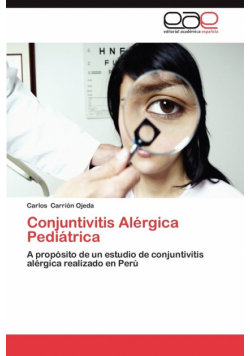 Conjuntivitis Alergica Pediatrica