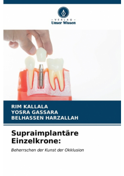 Supraimplantäre Einzelkrone