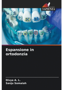 Espansione in ortodonzia