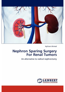 Nephron Sparing Surgery for Renal Tumors