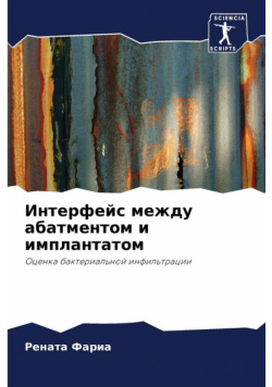 Интерфейс между абатментом и имплантатом