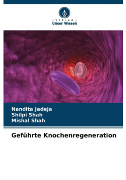 Geführte Knochenregeneration