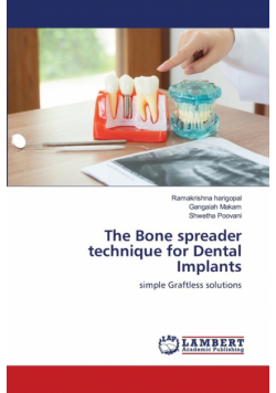The Bone spreader technique for Dental Implants