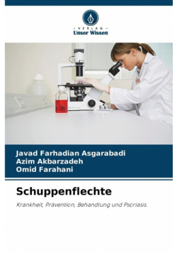 Schuppenflechte