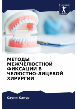 МЕТОДЫ МЕЖЧЕЛЮСТНОЙ ФИКСАЦИИ В ЧЕЛЮСТНО-ЛИЦЕВОЙ ХИРУРГИИ