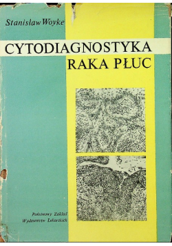 Cytodiagnostyka raka płuc