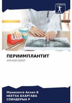 ПЕРИИМПЛАНТИТ
