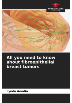 All you need to know about fibroepithelial breast tumors