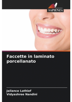 Faccette in laminato porcellanato