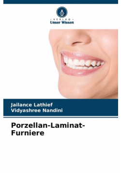 Porzellan-Laminat-Furniere