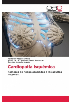 Cardiopatía isquémica