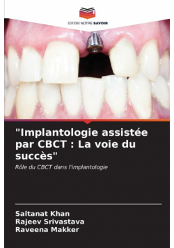 "Implantologie assistée par CBCT