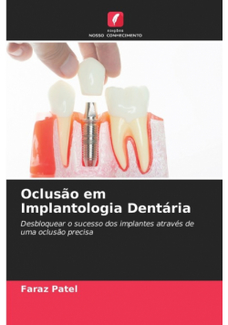 Oclusão em Implantologia Dentária