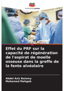 Effet du PRF sur la capacité de régénération de l'aspirat de moelle osseuse dans la greffe de la fente alvéolaire