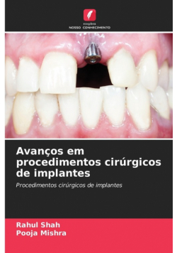 Avanços em procedimentos cirúrgicos de implantes
