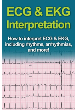 ECG & EKG Interpretation