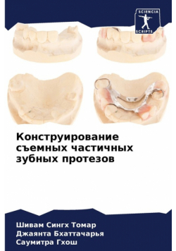 Конструирование съемных частичных зубных протезов