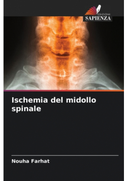 Ischemia del midollo spinale
