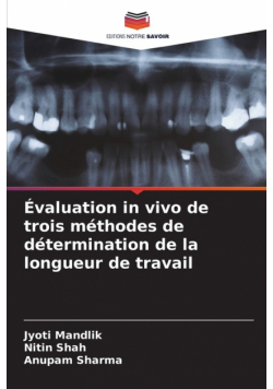 Évaluation in vivo de trois méthodes de détermination de la longueur de travail