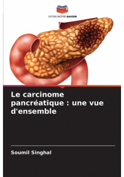 Le carcinome pancréatique