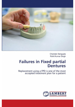 Failures in Fixed partial Dentures
