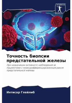 Точность биопсии предстательной железы