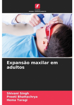Expansão maxilar em adultos
