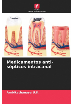 Medicamentos anti-sépticos intracanal