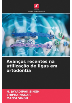 Avanços recentes na utilização de ligas em ortodontia
