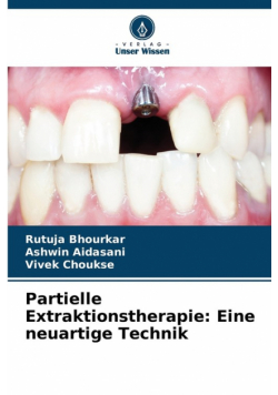 Partielle Extraktionstherapie