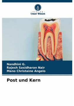 Post und Kern