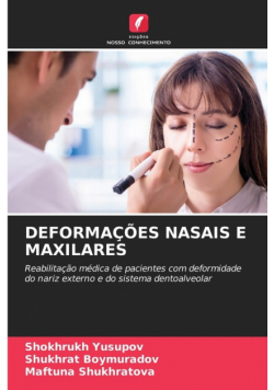 Deformações Nasais E Maxilares