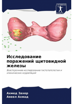 Исследование поражений щитовидной железы
