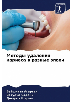 Методы удаления кариеса в разные эпохи