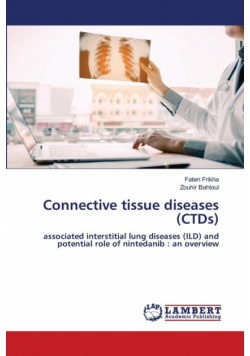 Connective tissue diseases (CTDs)