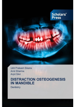 Distraction Osteogenesis In Mandible