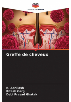 Greffe de cheveux