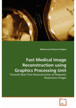 Fast Medical Image Reconstruction using Graphics Processing Unit