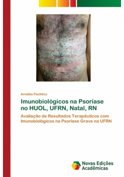 Imunobiológicos na Psoríase no HUOL, UFRN, Natal, RN