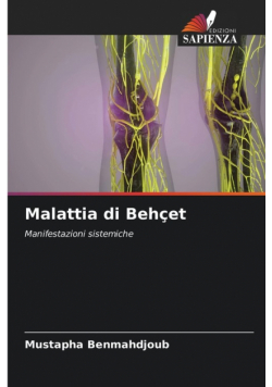 Malattia di Behçet