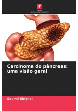 Carcinoma do pâncreas