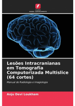 Lesões Intracranianas em Tomografia Computorizada Multislice (64 cortes)