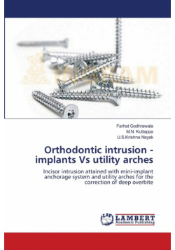 Orthodontic intrusion - implants Vs utility arches