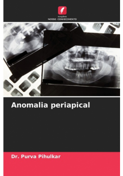 Anomalia periapical
