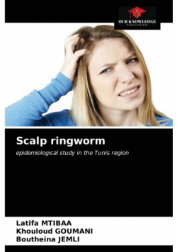 Scalp ringworm