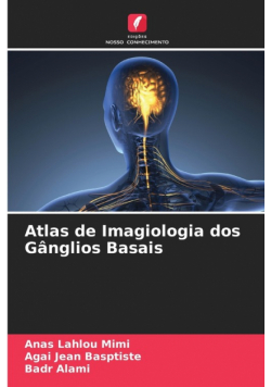 Atlas de Imagiologia dos Gânglios Basais